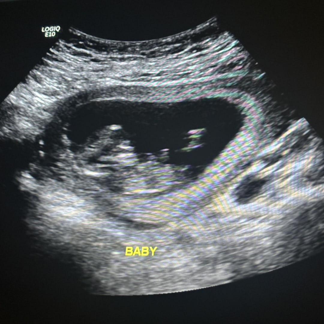 Photo shared by Hanna for their Babylist baby registry.