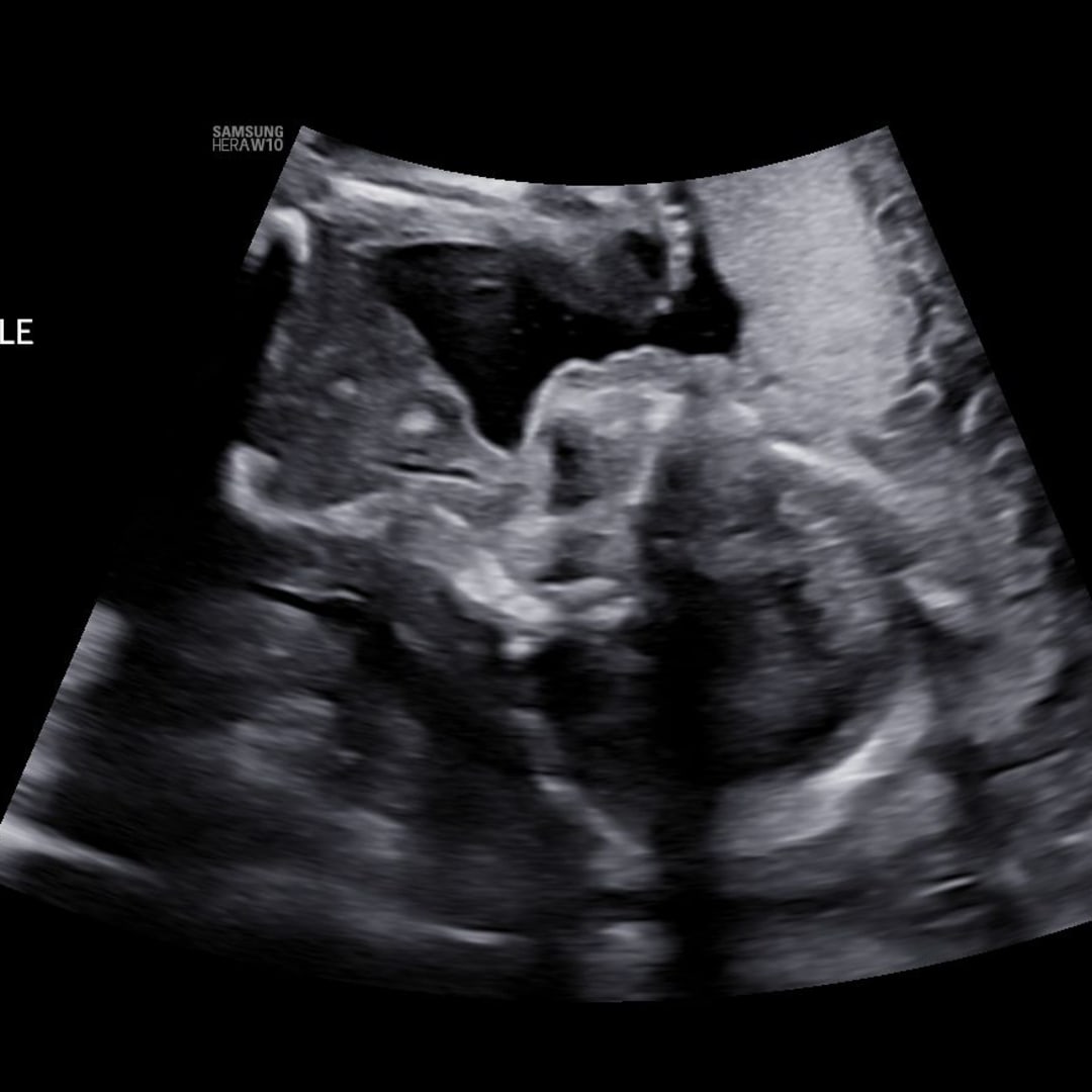 Photo shared by Gillian for their Babylist baby registry.