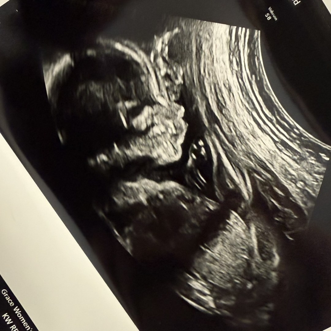 Photo shared by Kennedy for their Babylist baby registry.