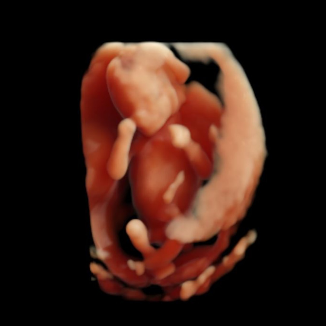 Photo shared by Kaylee for their Babylist baby registry.