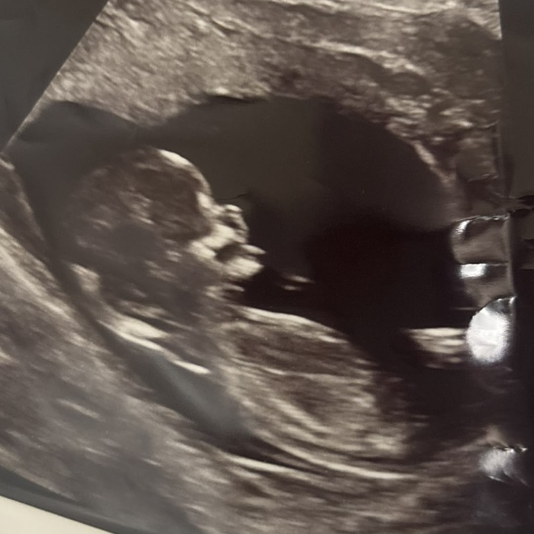 Photo shared by Jordan for their Babylist baby registry.