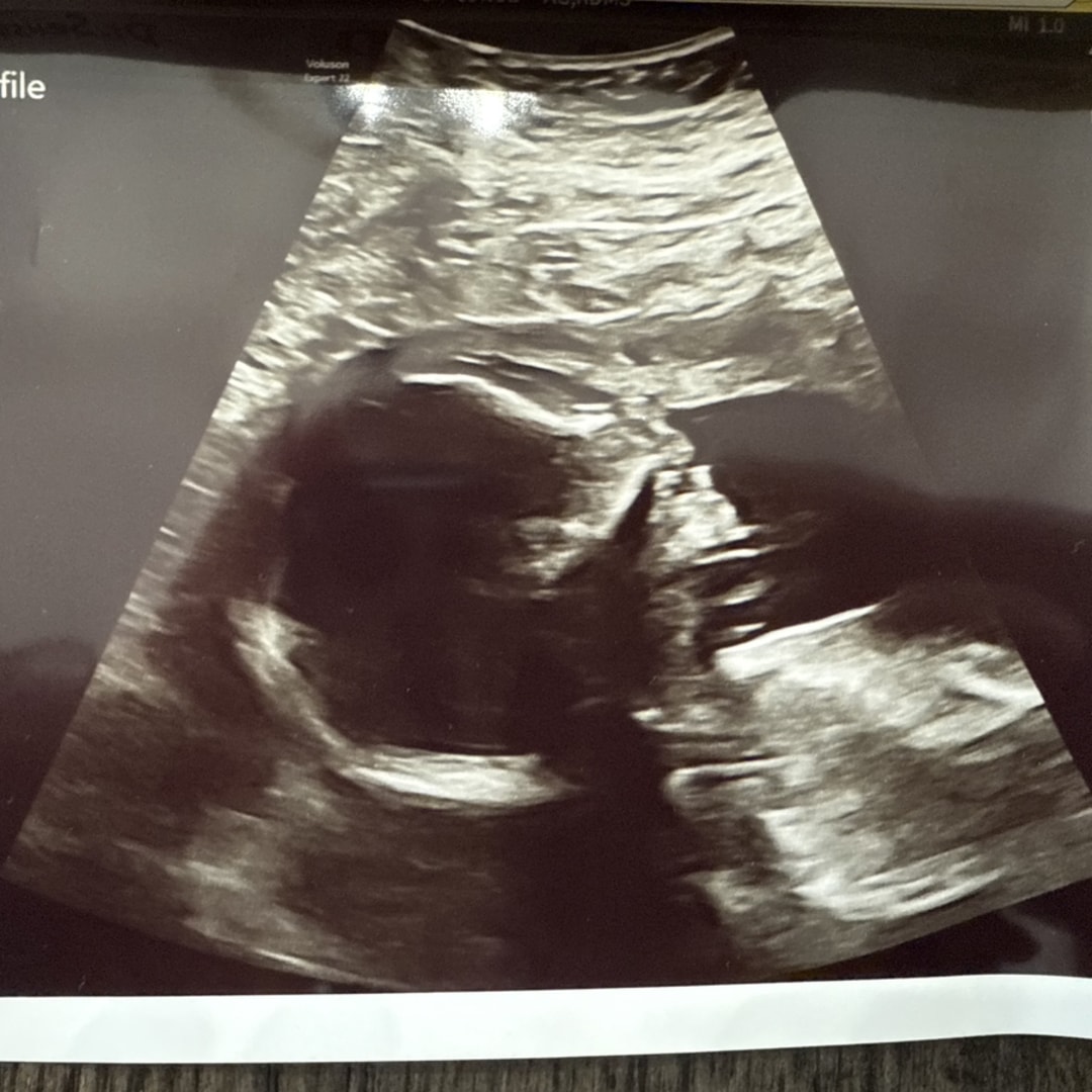 Photo shared by Randee for their Babylist baby registry.