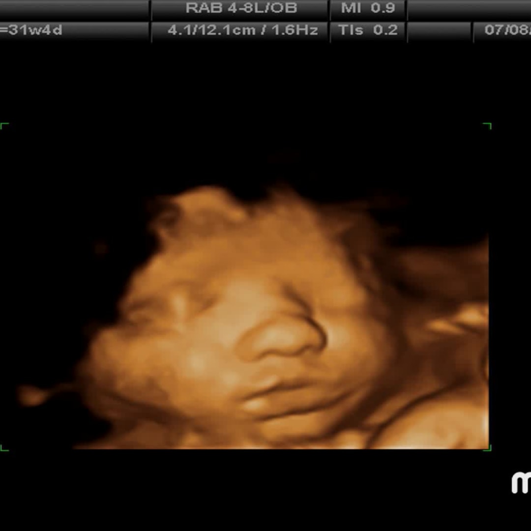 Photo shared by Cassidy for their Babylist baby registry.
