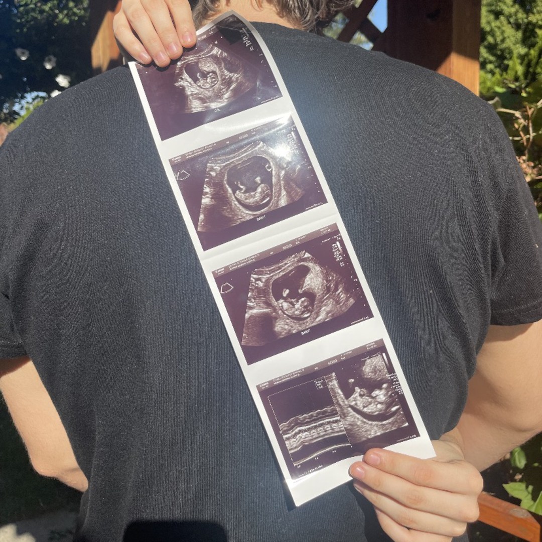 Photo shared by Shi for their Babylist baby registry.