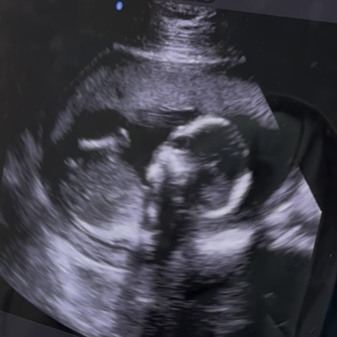 Photo shared by Allison for their Babylist baby registry.