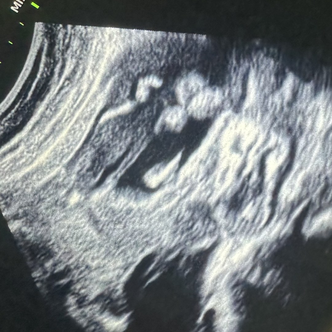 Photo shared by Mariah for their Babylist baby registry.