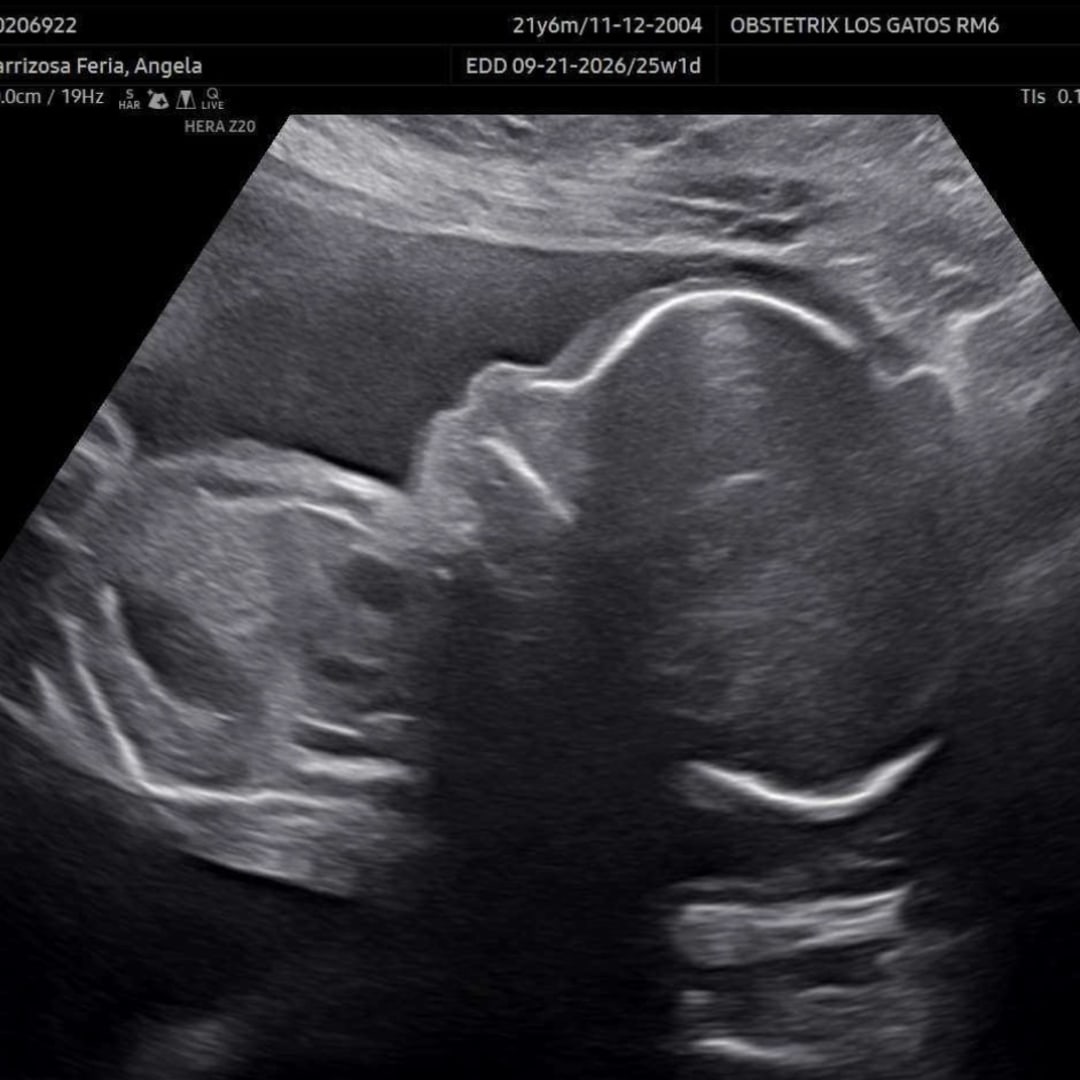 Photo shared by Angela for their Babylist baby registry.