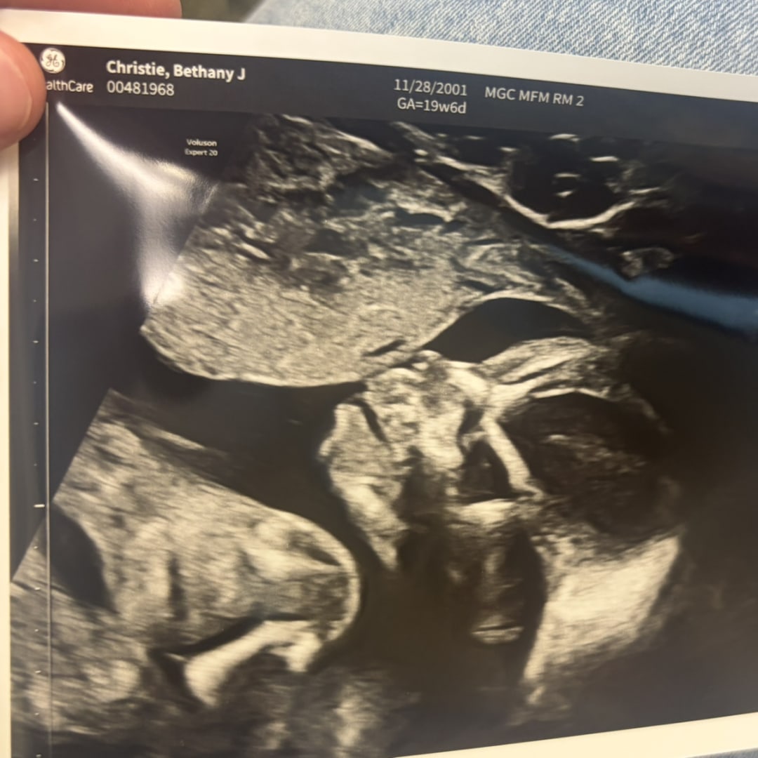 Photo shared by Bethany for their Babylist baby registry.