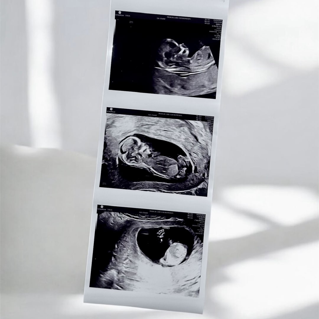 Photo shared by Bella for their Babylist baby registry.