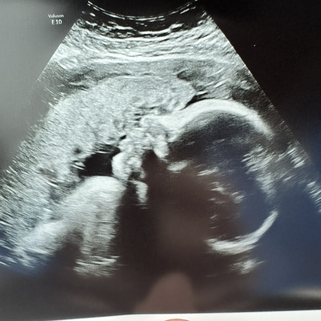 Photo shared by Lacey for their Babylist baby registry.