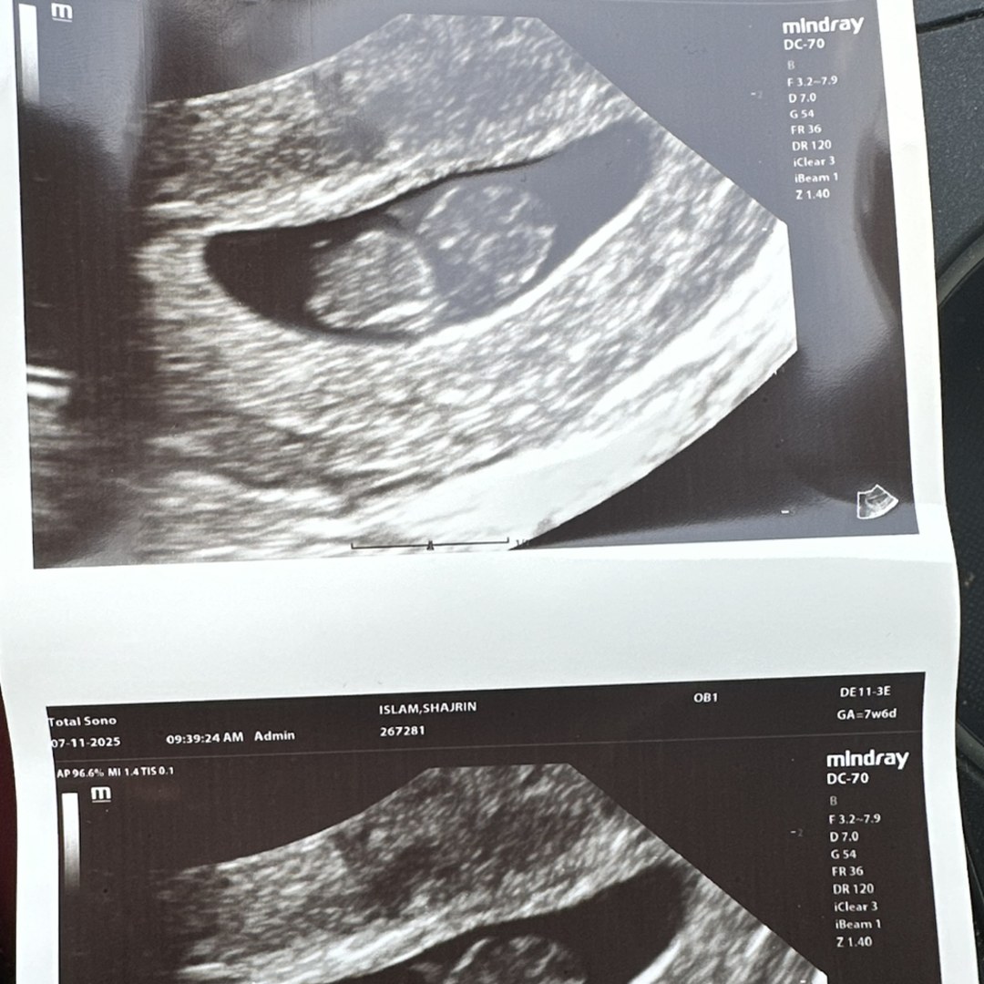 Photo shared by Shajrin for their Babylist baby registry.