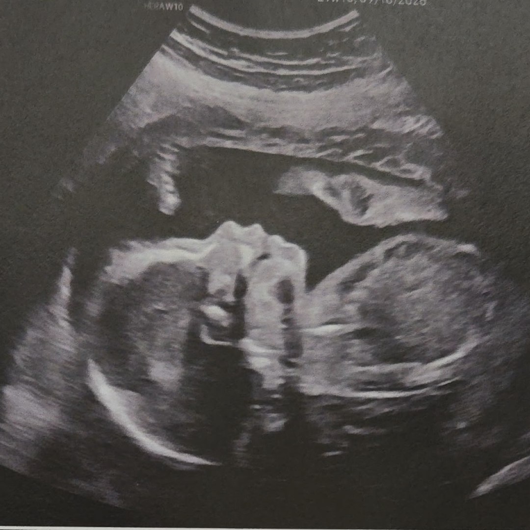 Photo shared by Wendy for their Babylist baby registry.