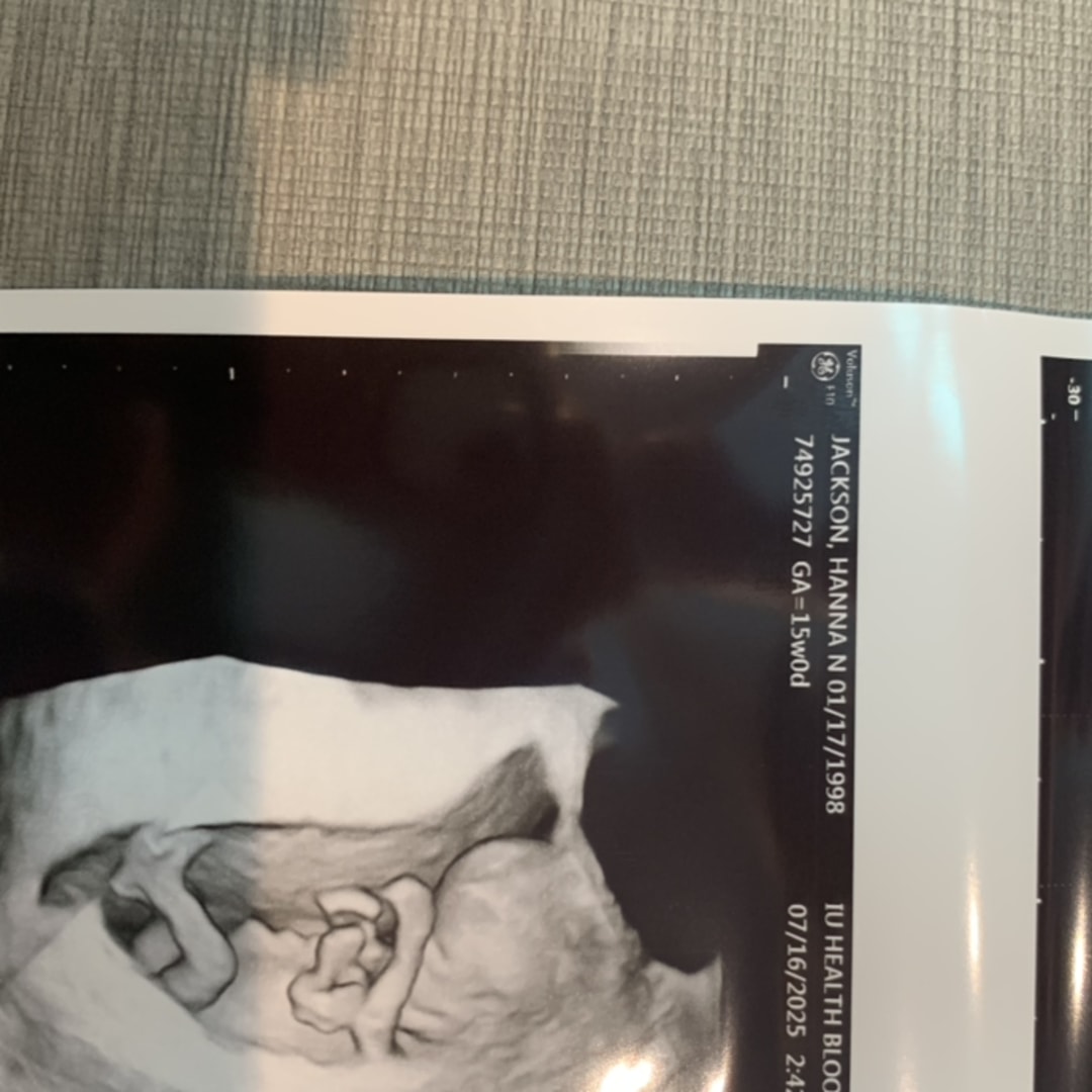 Photo shared by Hanna for their Babylist baby registry.