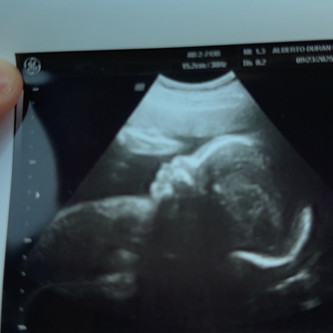 Photo shared by Ashly for their Babylist baby registry.