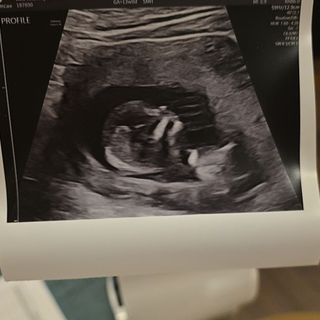 Photo shared by Raven for their Babylist baby registry.