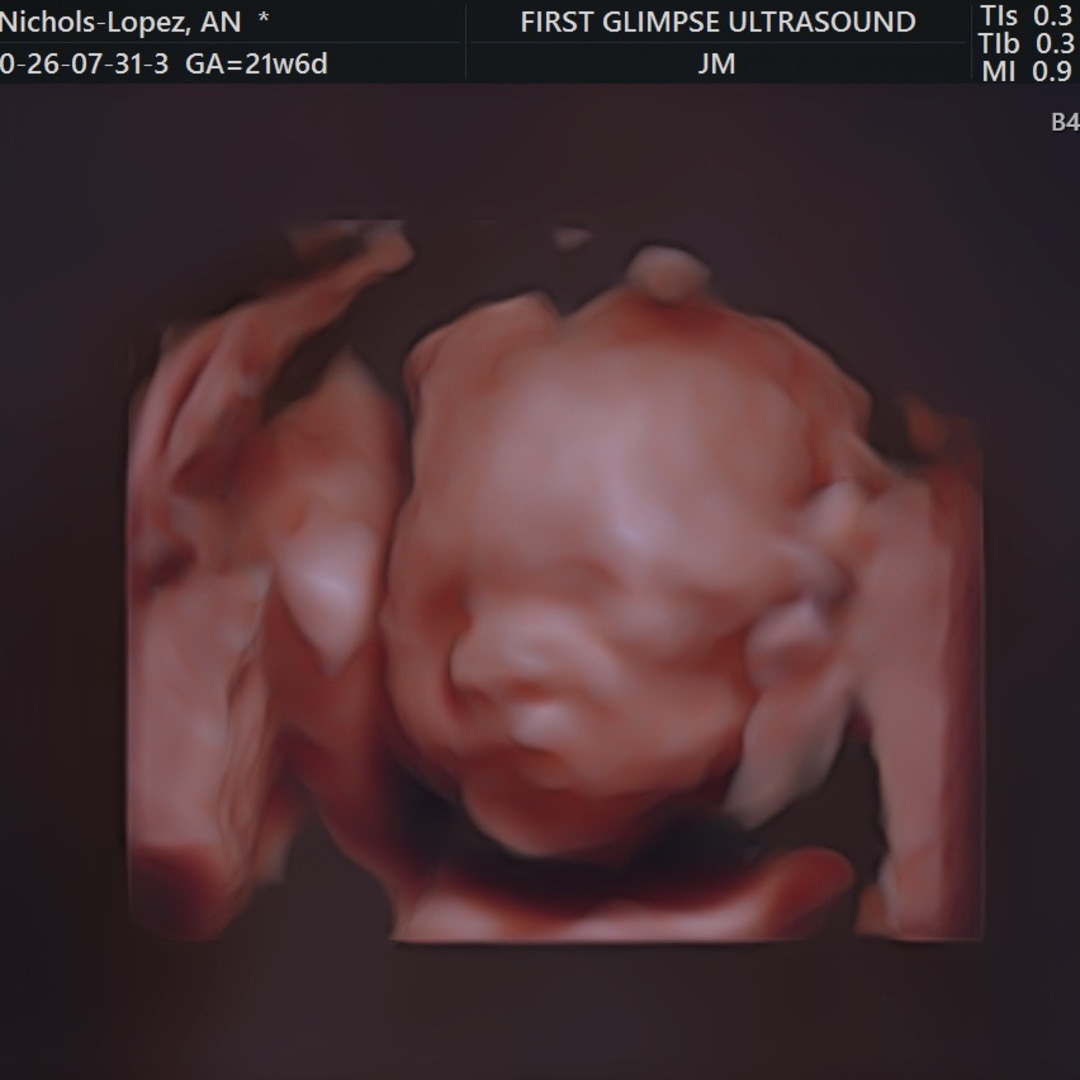Photo shared by Alejandra for their Babylist baby registry.