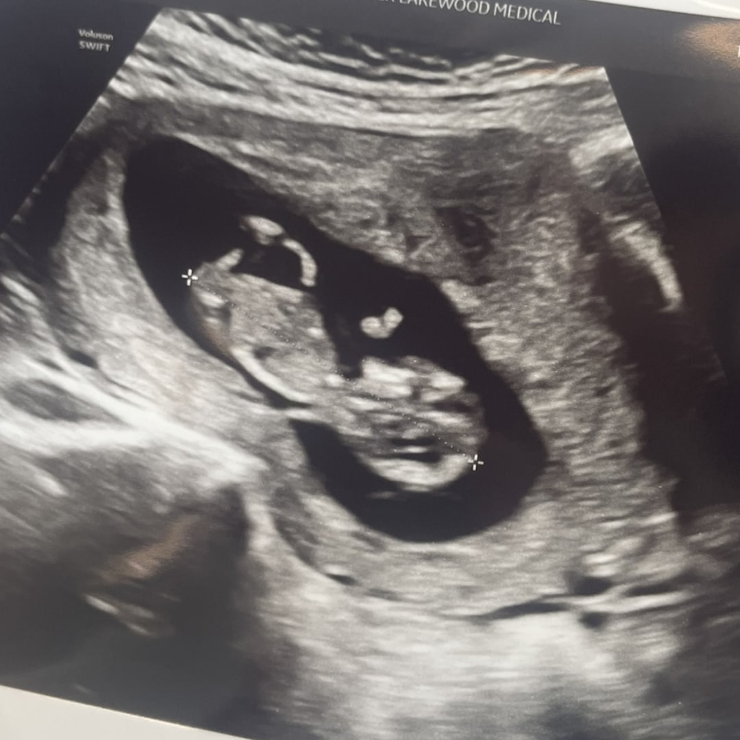 Photo shared by Alondra for their Babylist baby registry.