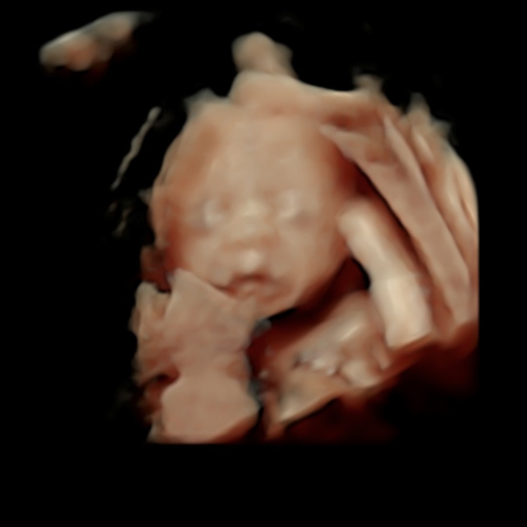 Photo shared by Sara for their Babylist baby registry.