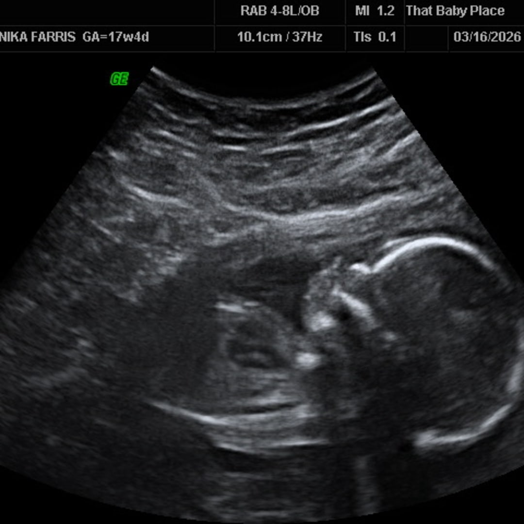 Photo shared by Dannika for their Babylist baby registry.