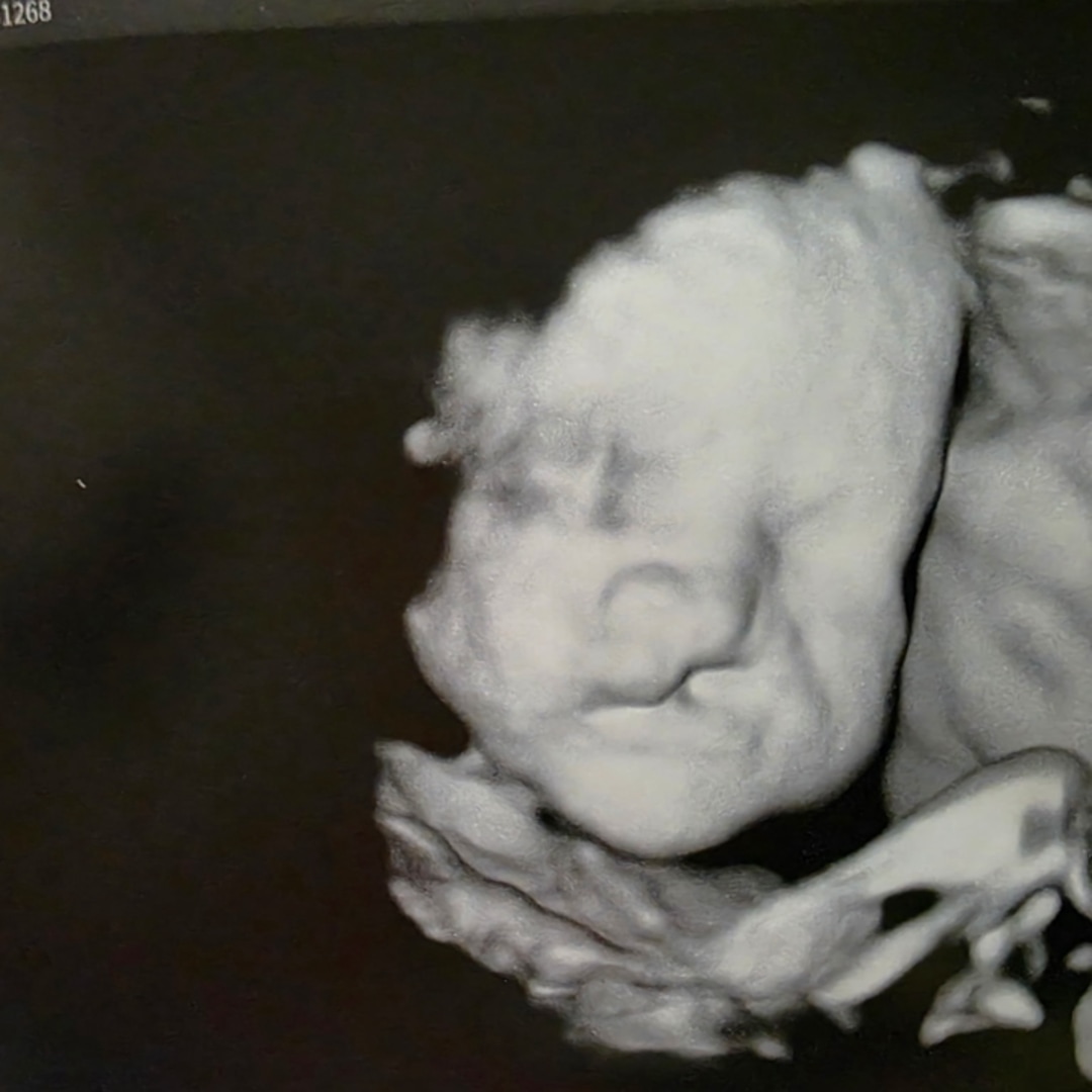 Photo shared by Renee for their Babylist baby registry.