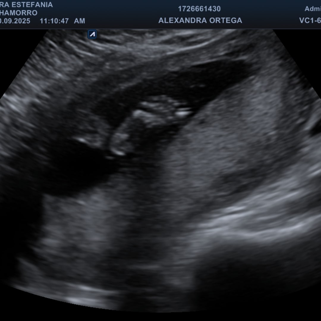 Photo shared by Alexandra for their Babylist baby registry.