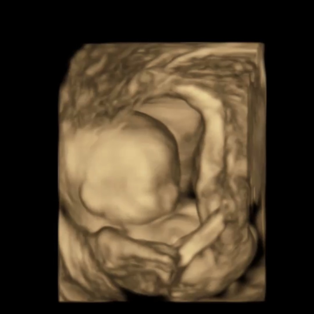 Photo shared by Desyrae for their Babylist baby registry.