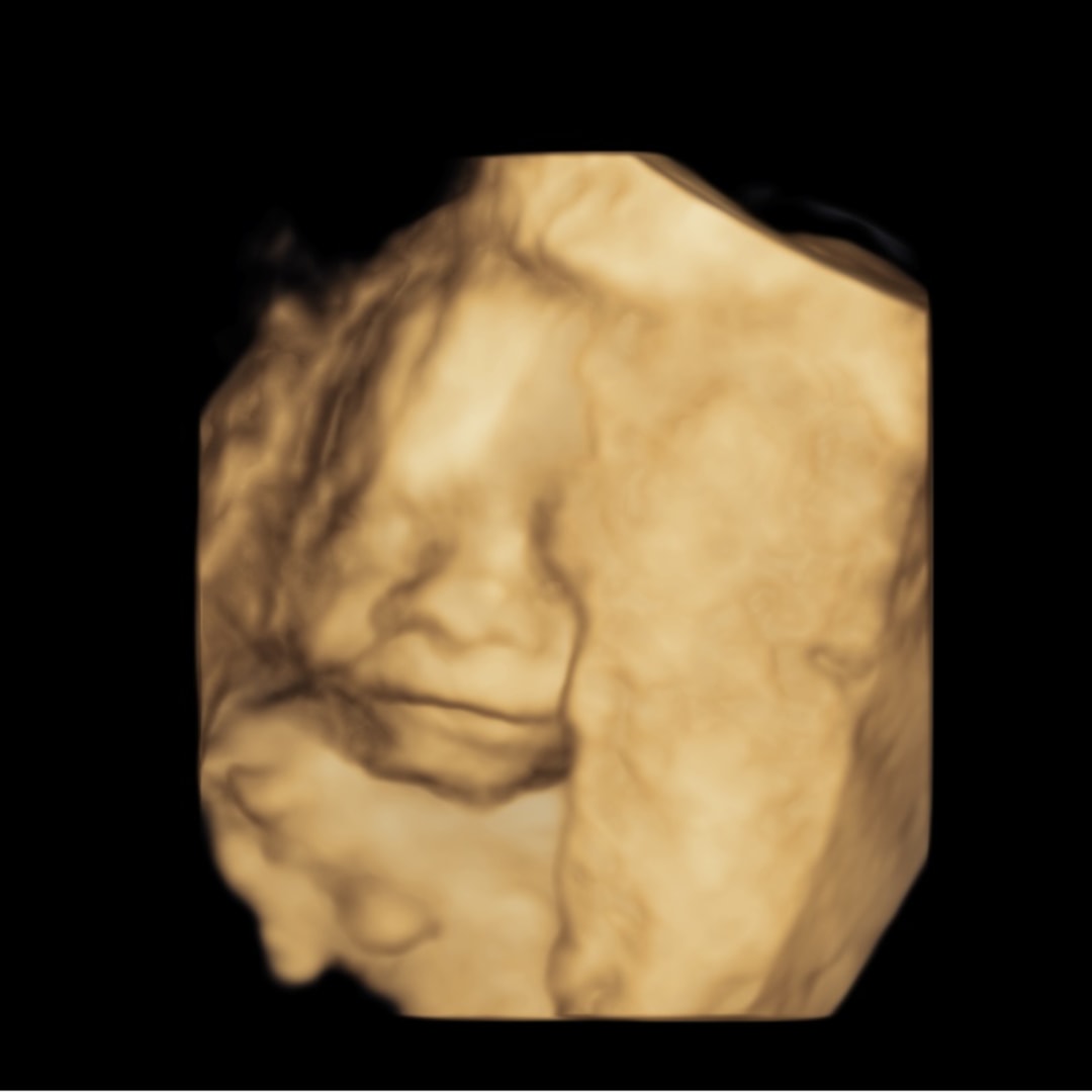 Photo shared by Andrea for their Babylist baby registry.