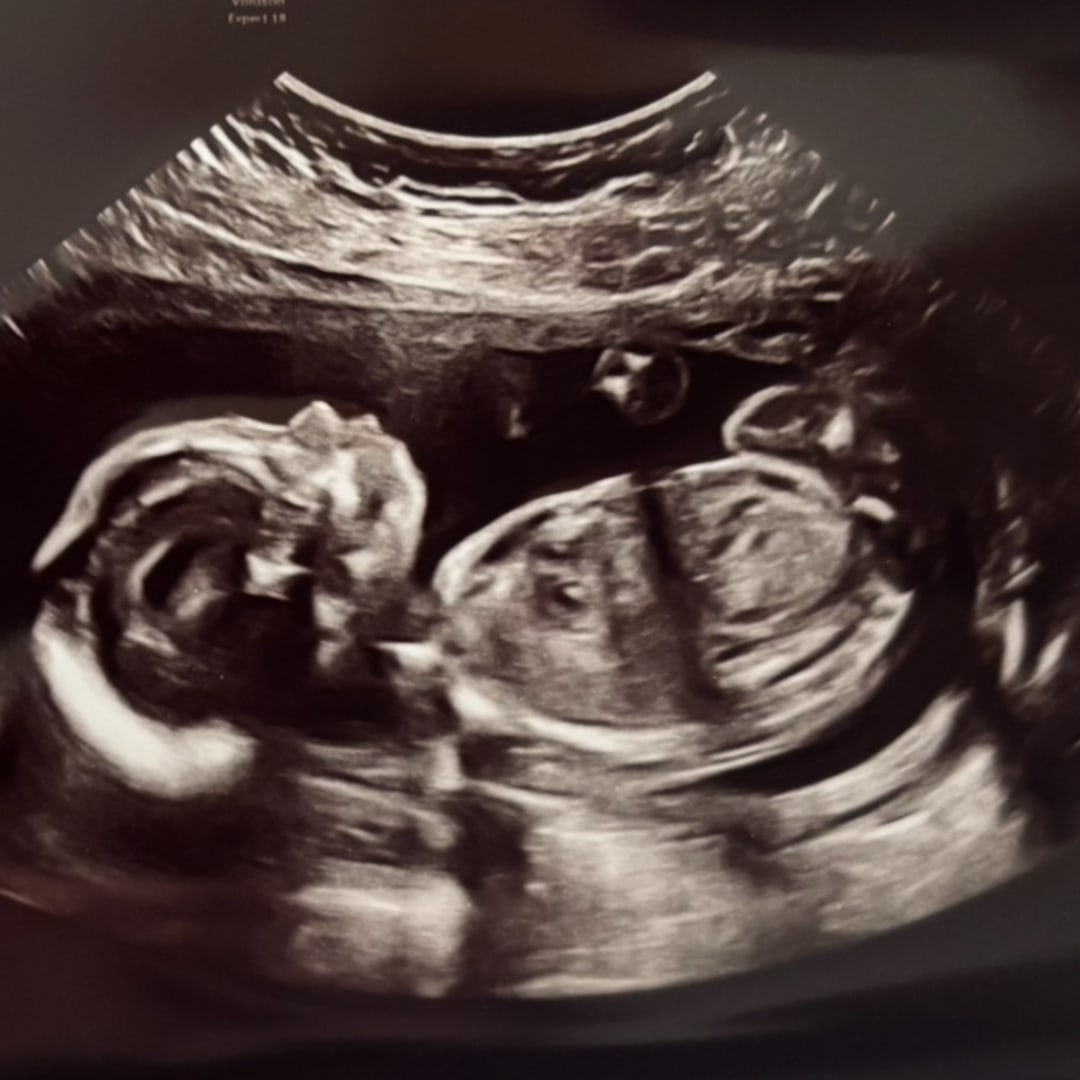 Photo shared by Cailey for their Babylist baby registry.