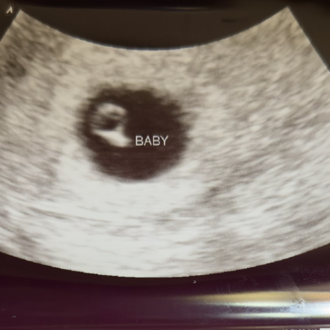 Photo shared by Angela for their Babylist baby registry.