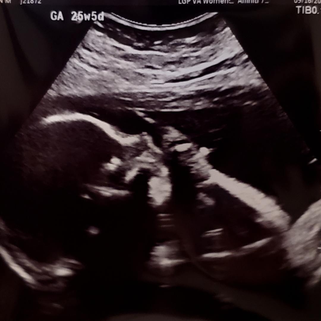 Photo shared by Katelyn for their Babylist baby registry.