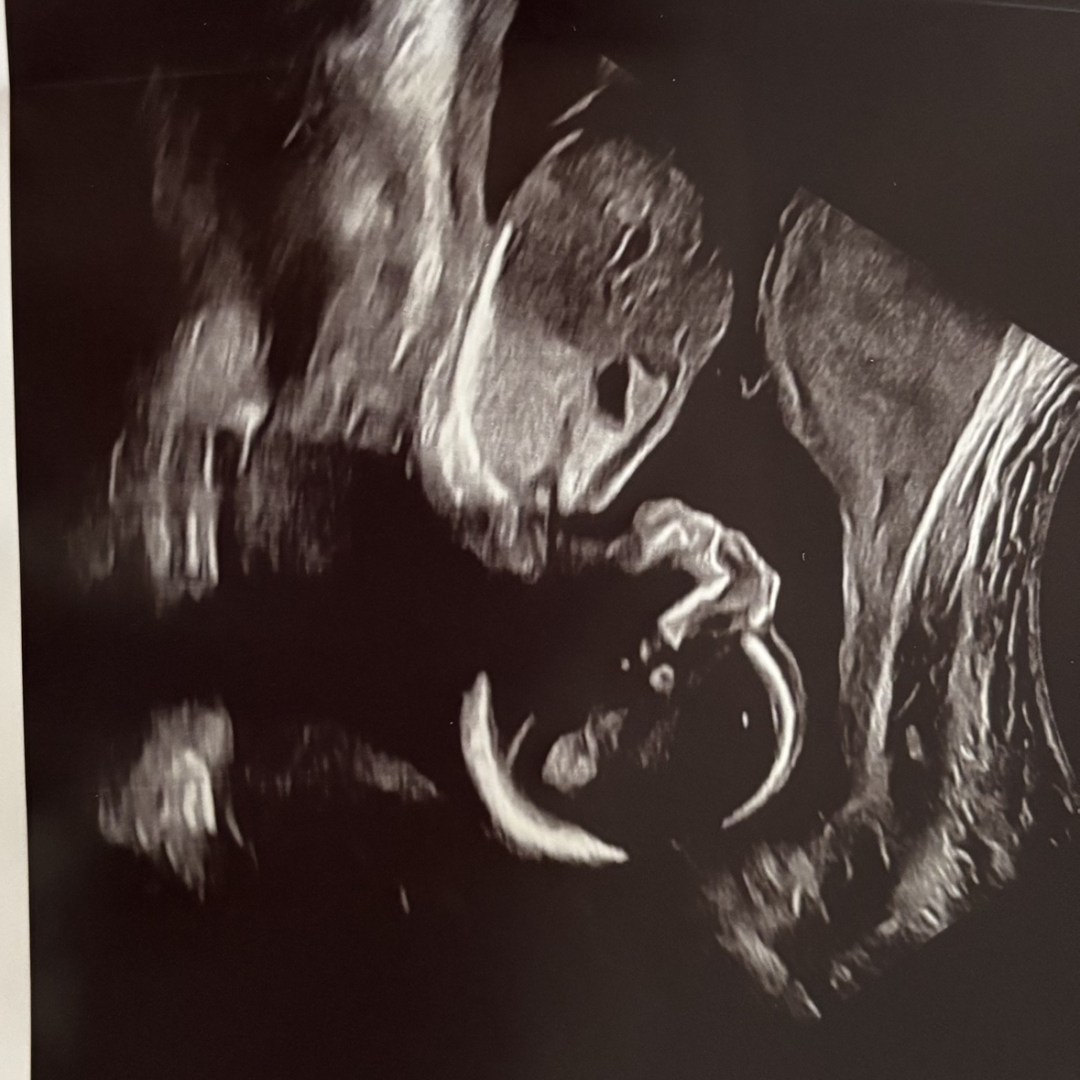 Photo shared by Caileigh for their Babylist baby registry.