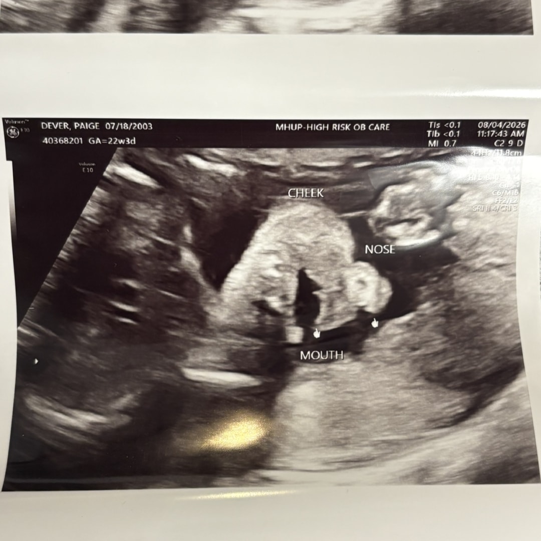 Photo shared by Paige for their Babylist baby registry.