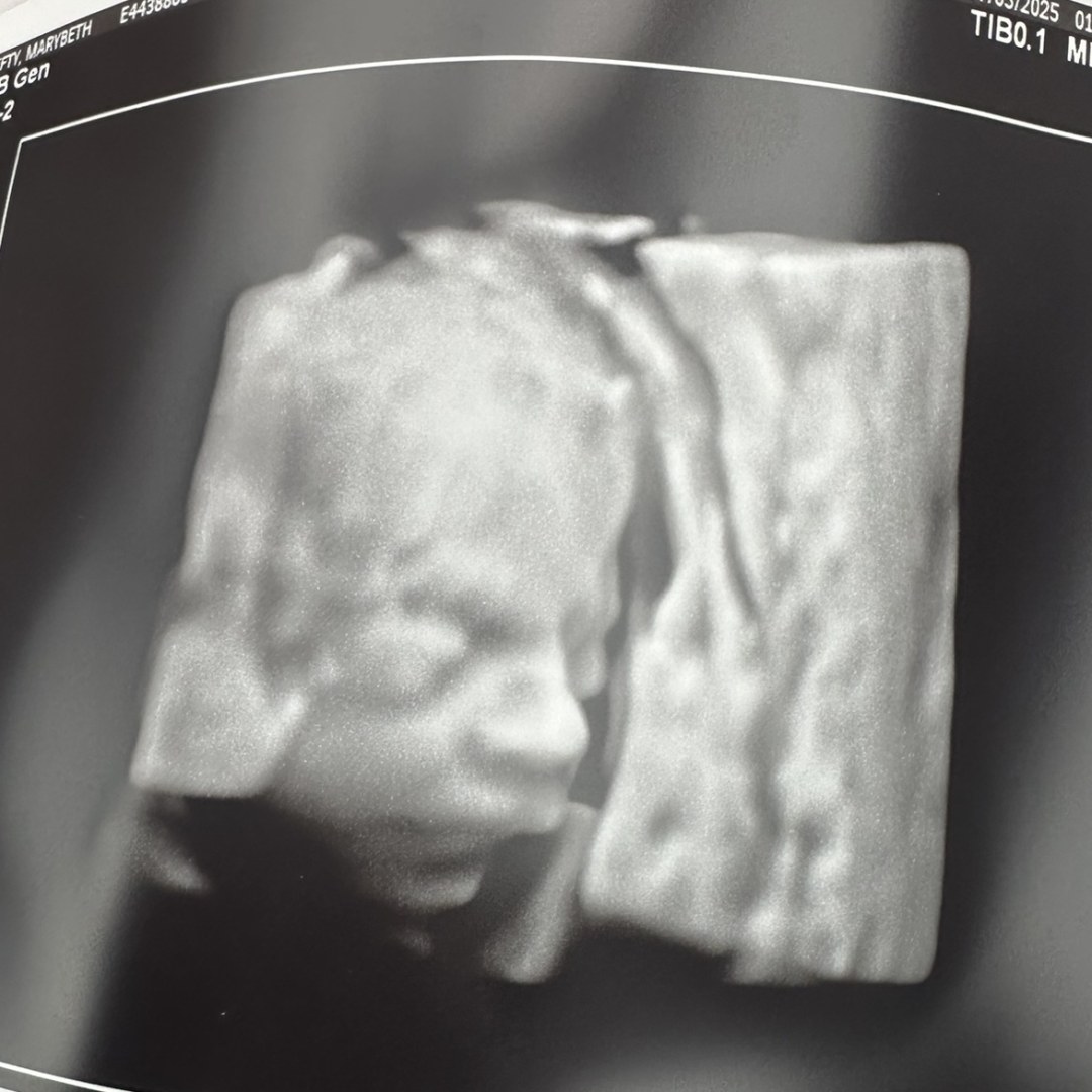 Photo shared by Marybeth for their Babylist baby registry.