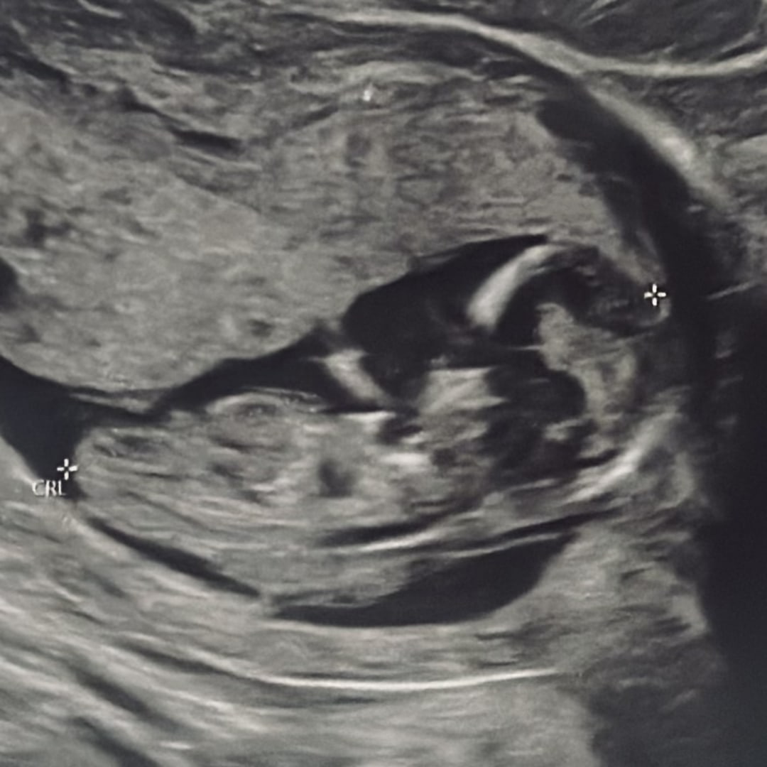 Photo shared by Gabriella for their Babylist baby registry.