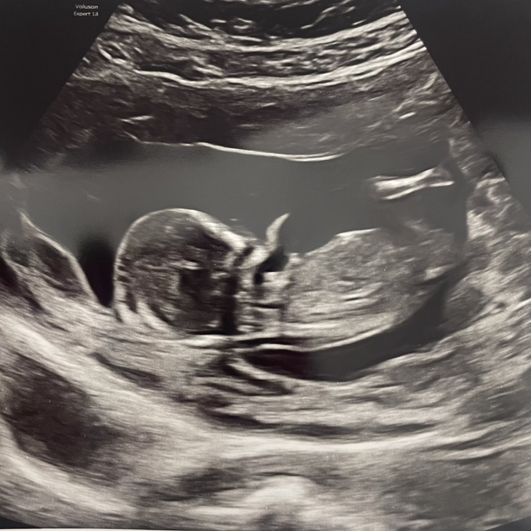 Photo shared by Megan & Collin for their Babylist baby registry.