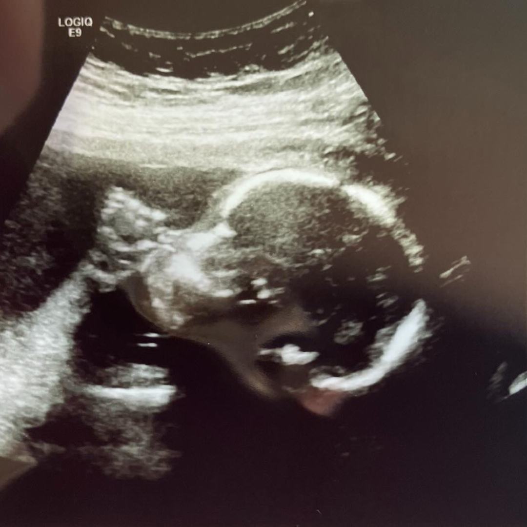 Photo shared by Christina for their Babylist baby registry.