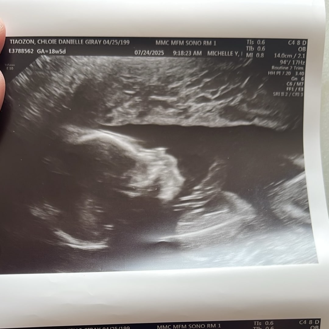 Photo shared by Chloie for their Babylist baby registry.
