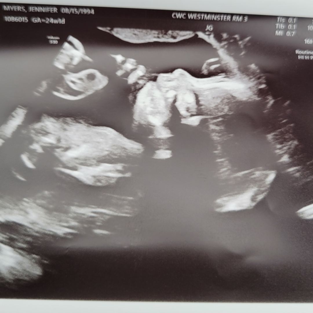 Photo shared by Jenni for their Babylist baby registry.