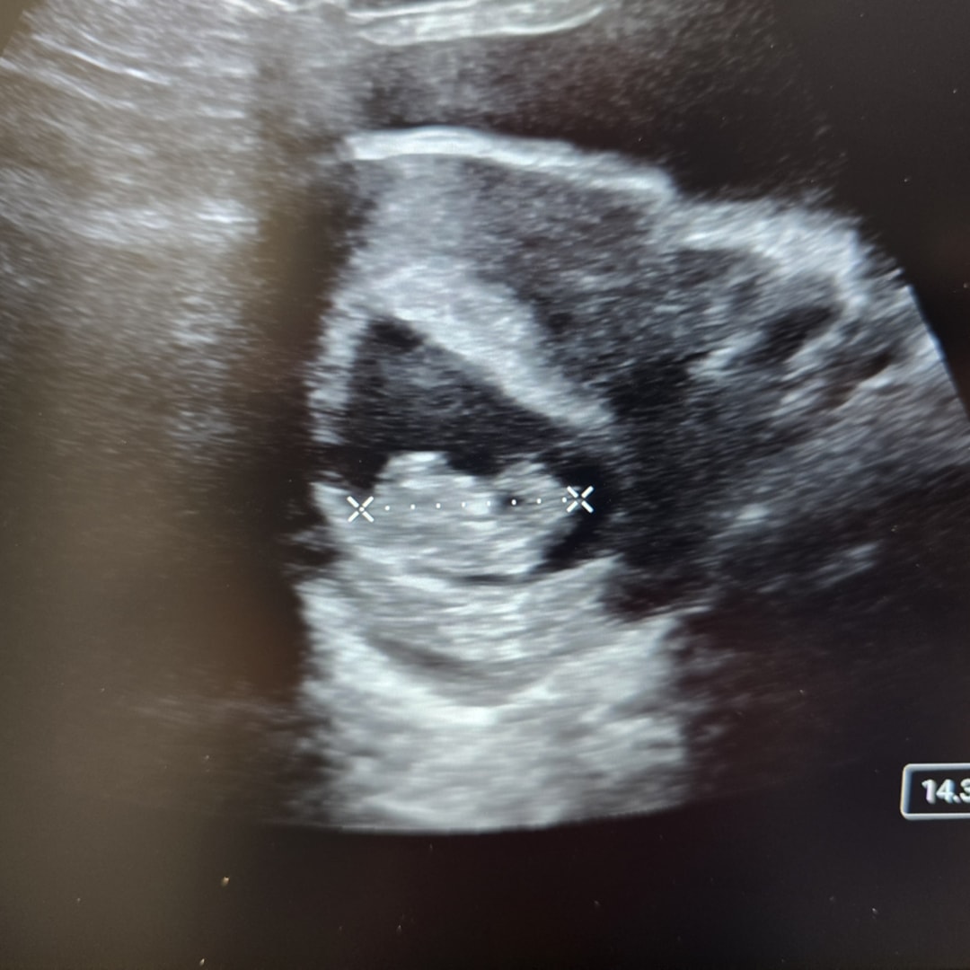 Photo shared by Emily for their Babylist baby registry.