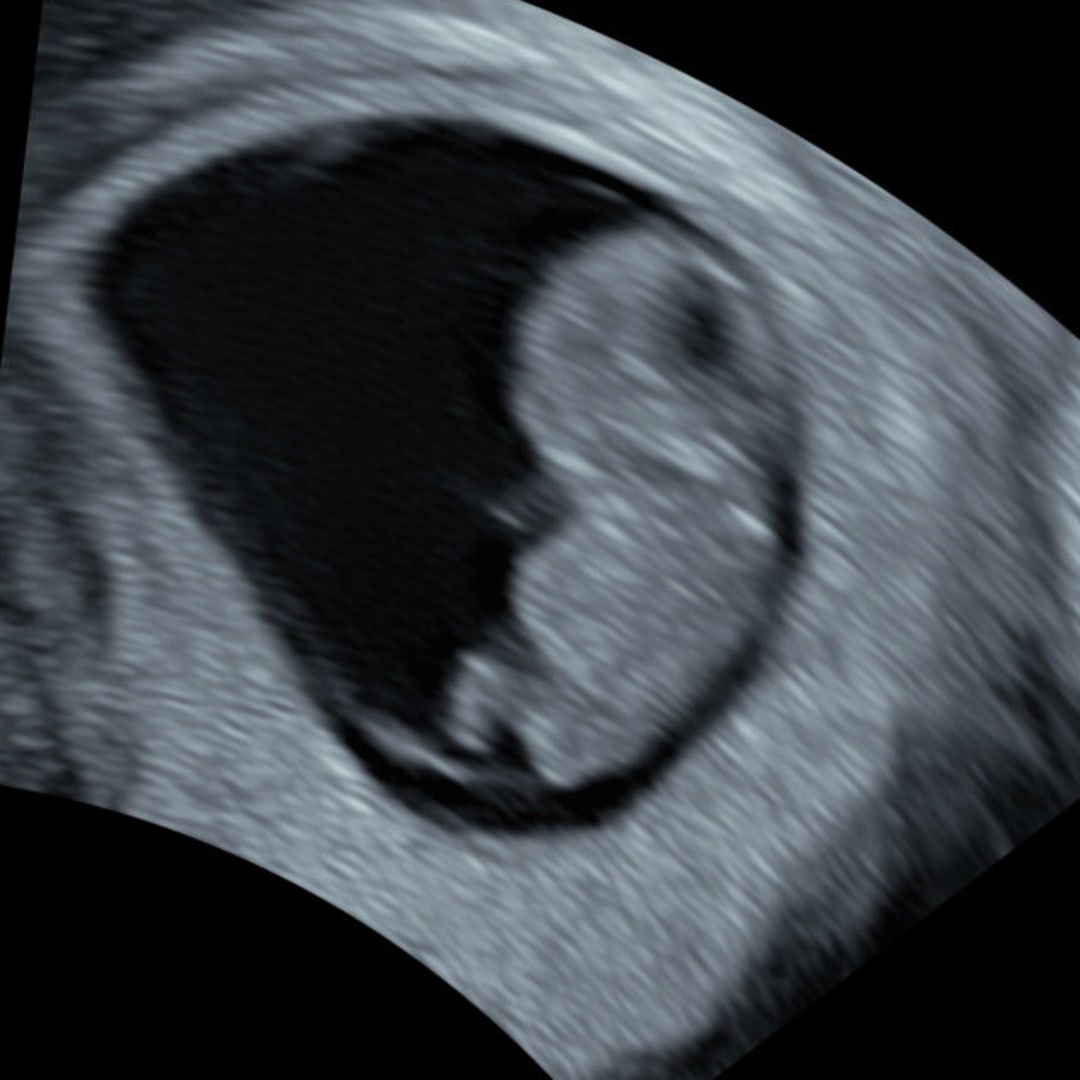 Photo shared by Haley for their Babylist baby registry.