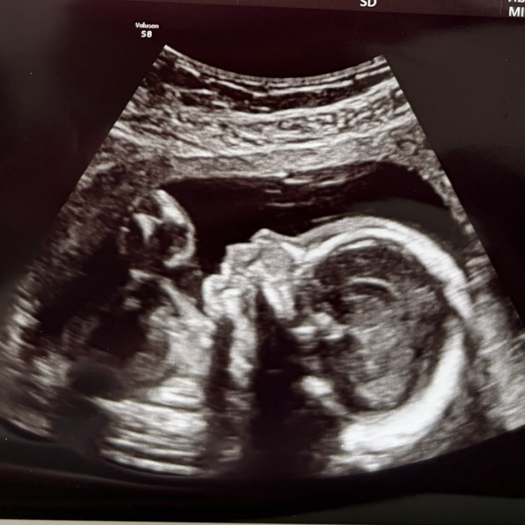 Photo shared by Brianna for their Babylist baby registry.