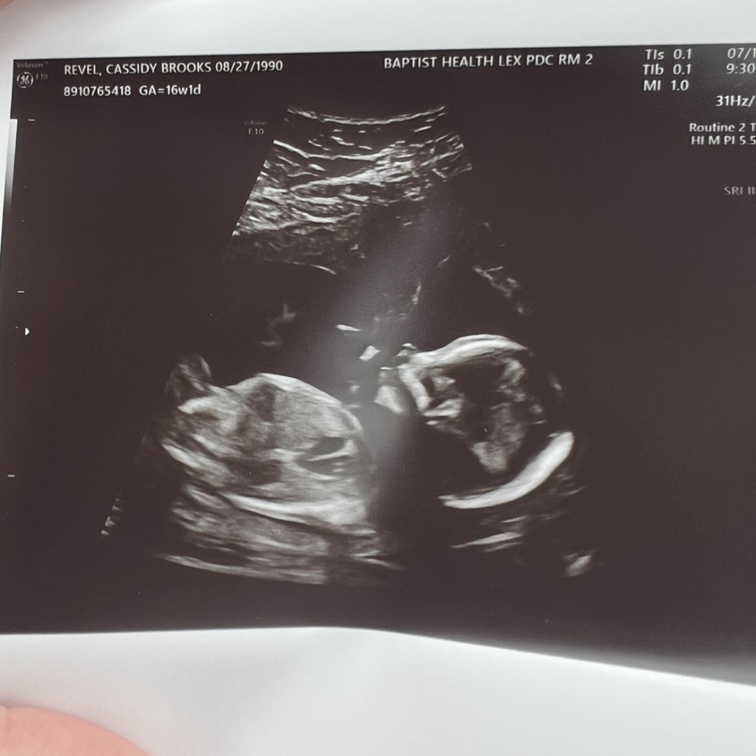Photo shared by Cassidy for their Babylist baby registry.