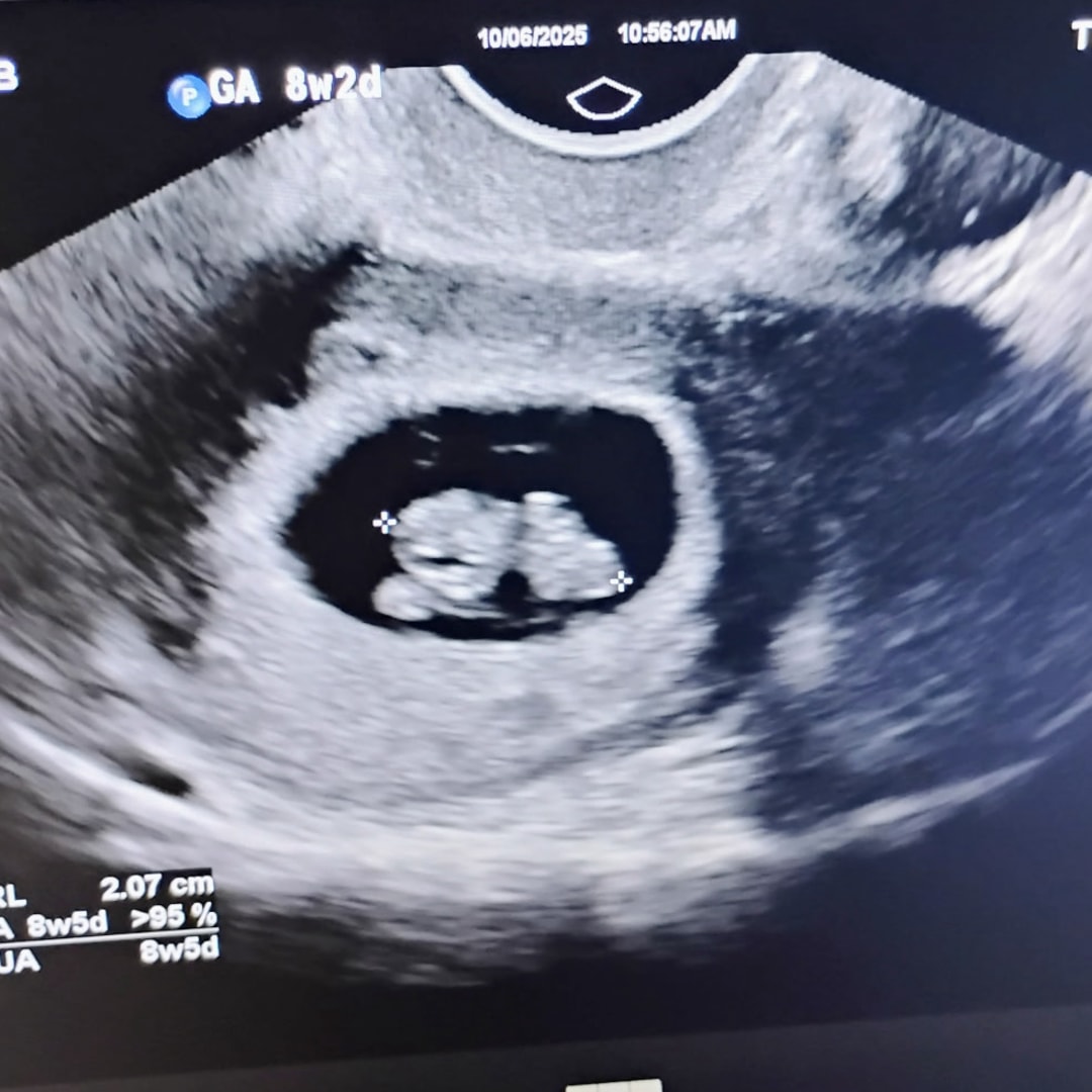 Photo shared by Madison for their Babylist baby registry.