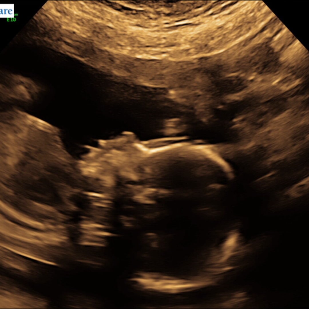 Photo shared by Amy for their Babylist baby registry.