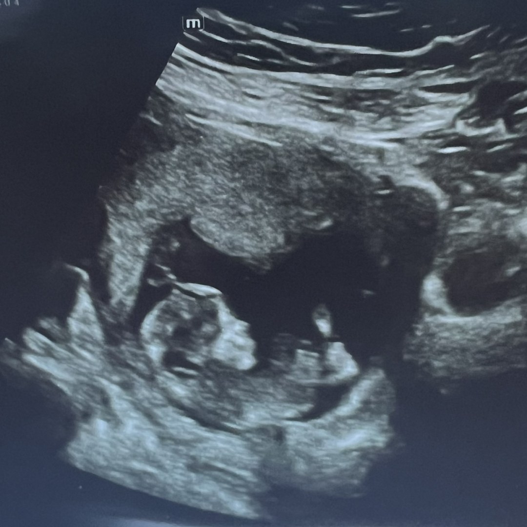 Photo shared by Emma for their Babylist baby registry.