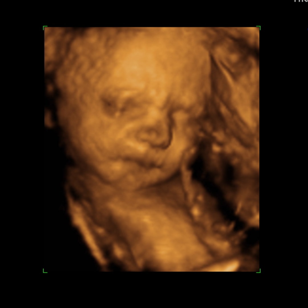 Photo shared by Toni for their Babylist baby registry.