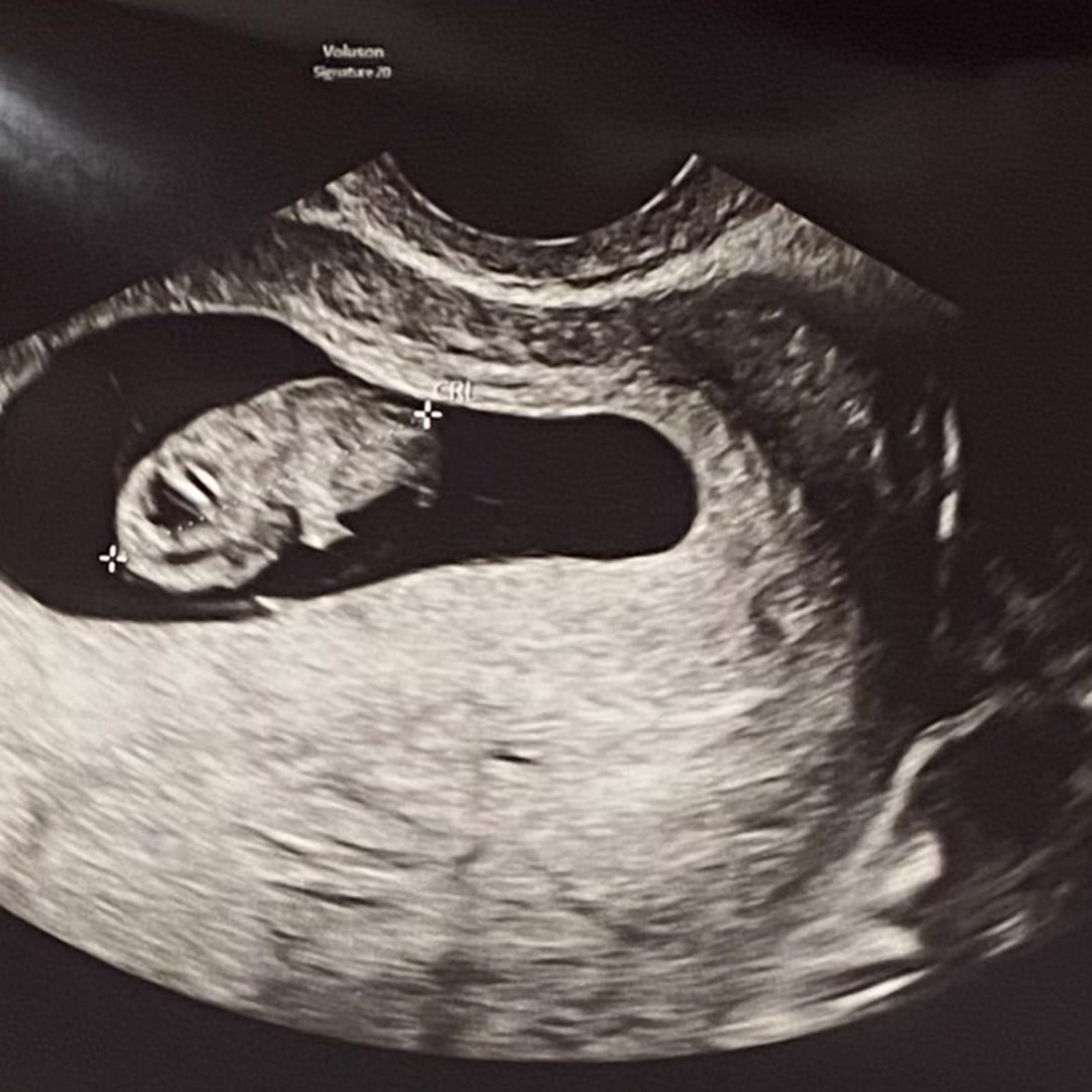 Photo shared by Gabrielle for their Babylist baby registry.