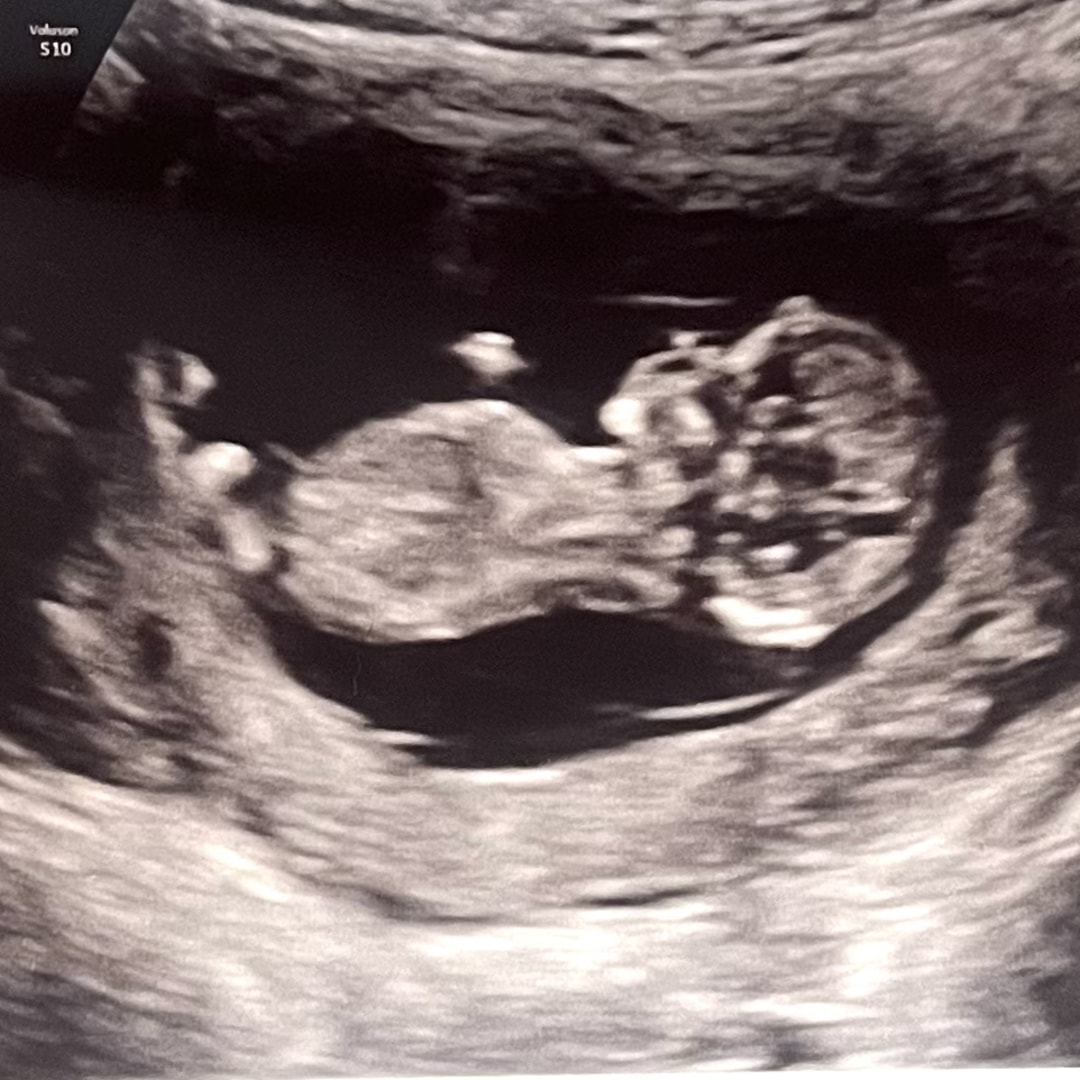 Photo shared by Melanie for their Babylist baby registry.