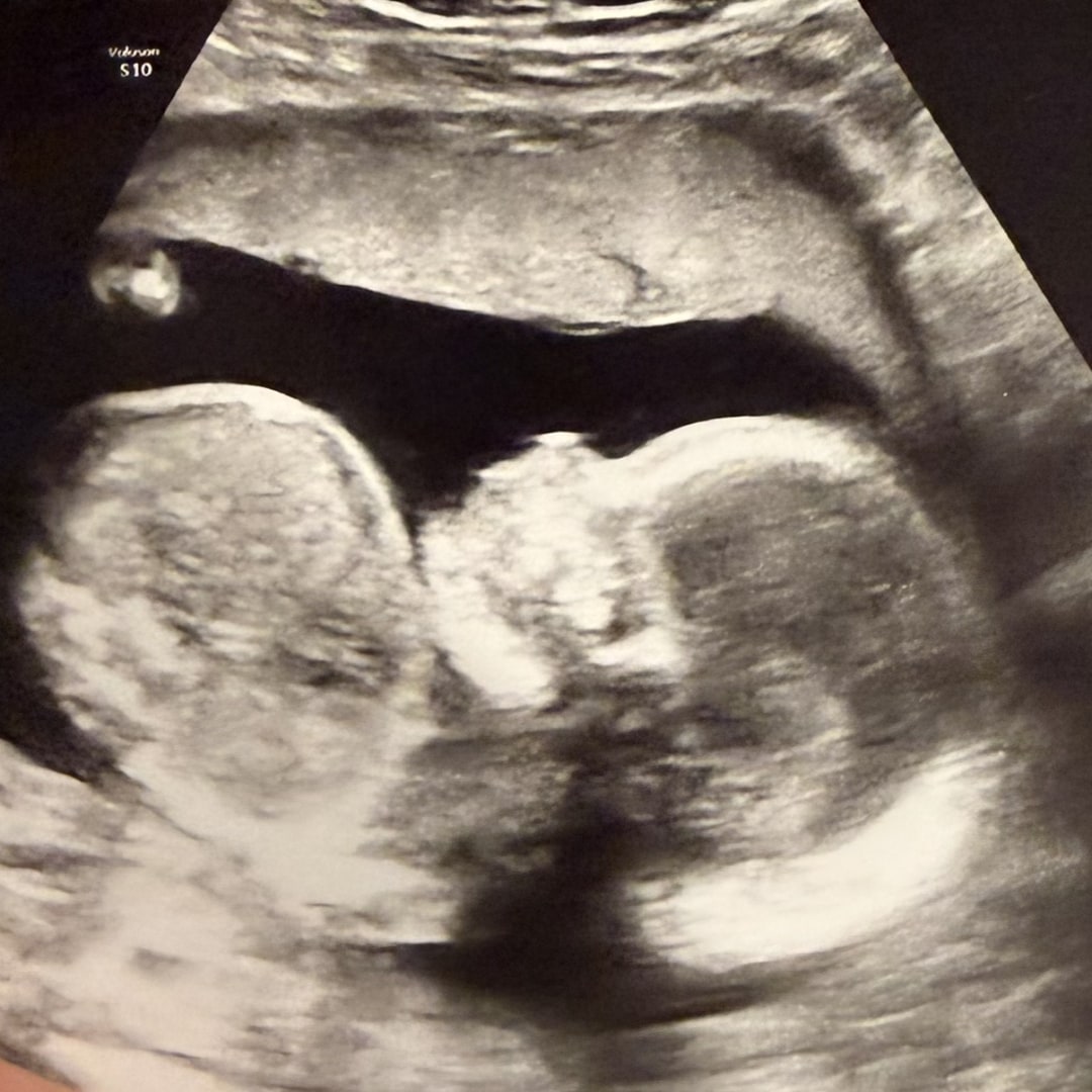 Photo shared by Imani for their Babylist baby registry.