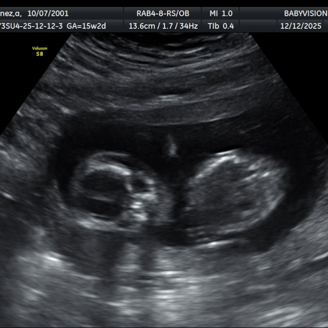 Photo shared by Angelina for their Babylist baby registry.